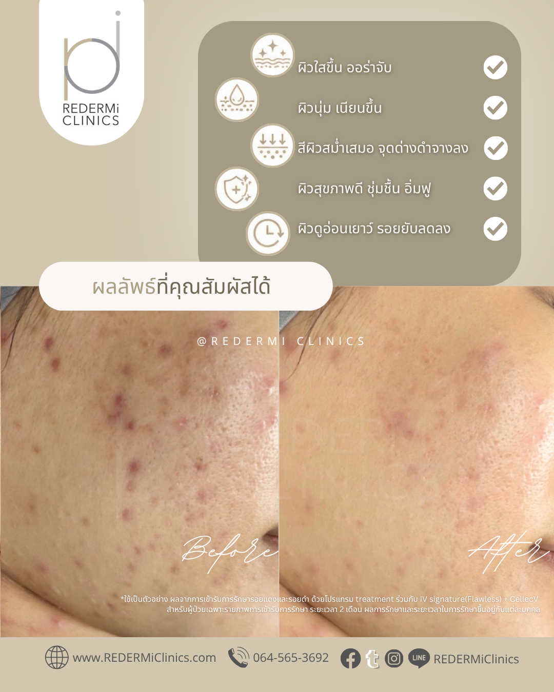 โปรแกรม dualBright&dualShine - Image 3